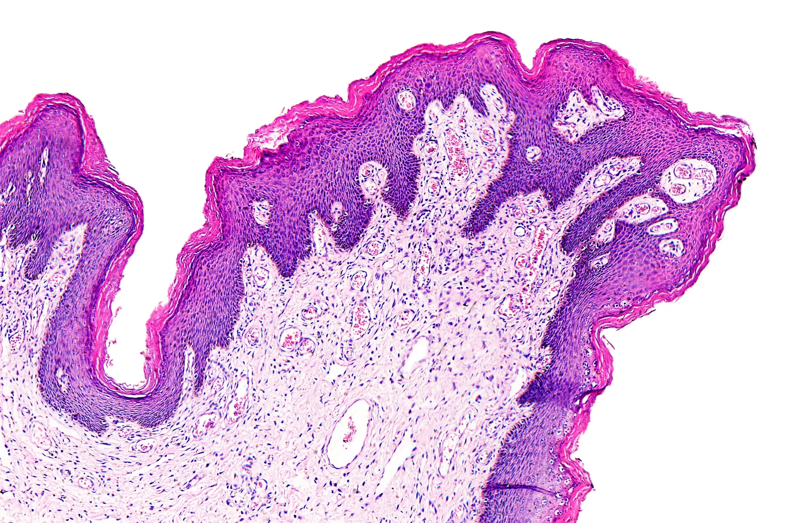 Pathology News Roundup: April 20, 2022